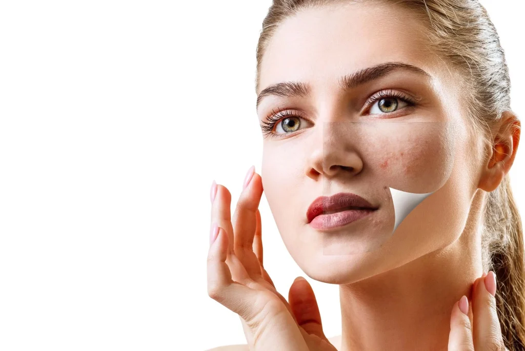 laser για ευρυαγγείες